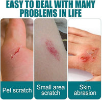 First Aid Liquid Bandage (10ml)